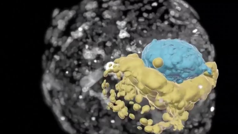 Israeli scientists create human embryo model without using sperm or eggs