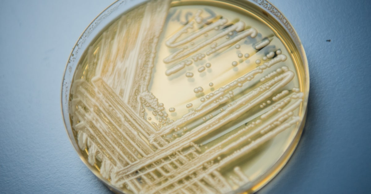 Washington faces first outbreak of a deadly fungal infection that’s on the rise in the U.S.