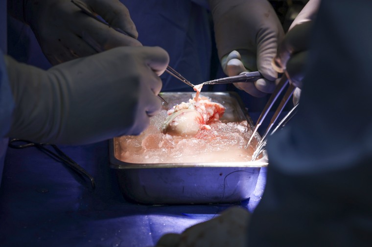 In a first, surgeons successfully transplant a pig kidney into a man