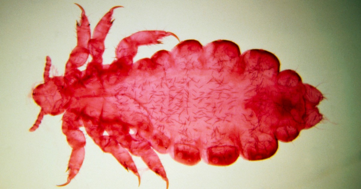 Blood-sucking body lice may have spread plague more than thought, science suggests