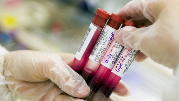 FDA approves blood test to screen for colon cancer