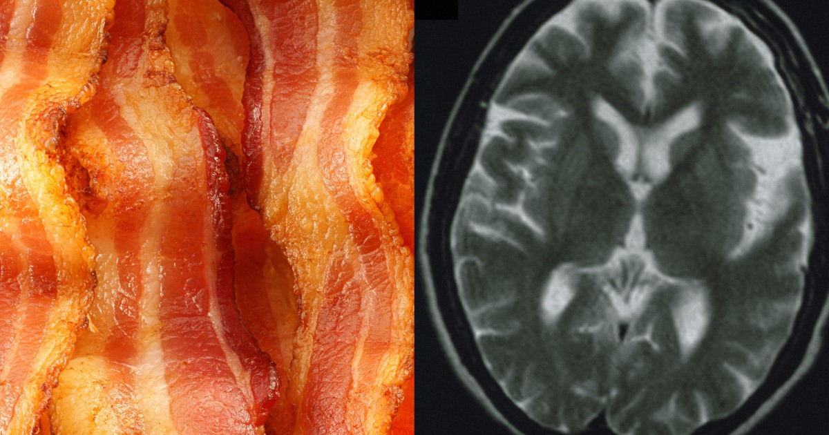 Is bacon bad for your brain? Study links processed red meat to increased risk of dementia