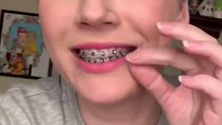 D-I-Why?? Dental experts warn against do-it-yourself braces