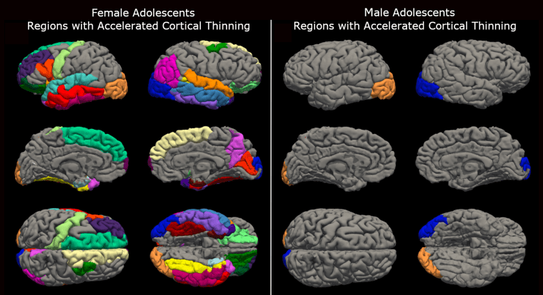 Teen brains ‘aged’ during Covid lockdowns, new research suggests