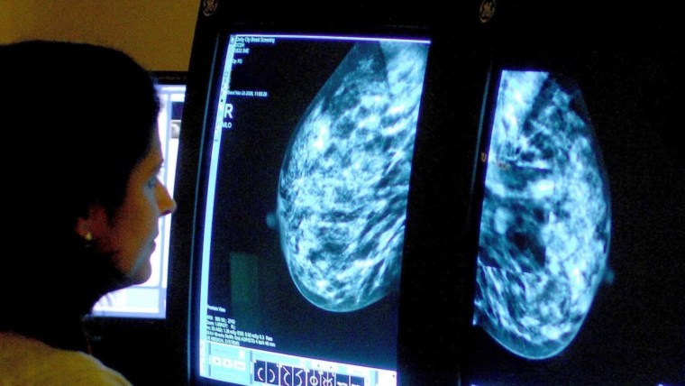 American Cancer Society report finds rise in breast cancer cases in younger women