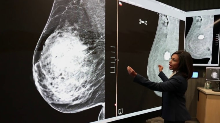 New mammogram could detect more breast cancers