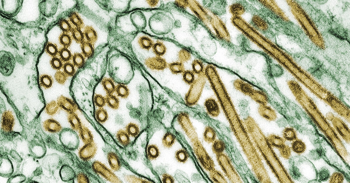 Teen with bird flu in Canada hospitalized in critical condition